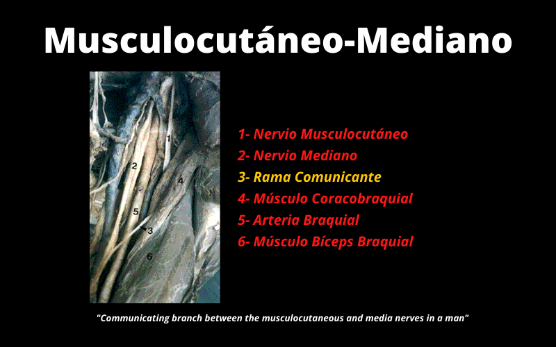 Musculocutaneo-Mediano.png